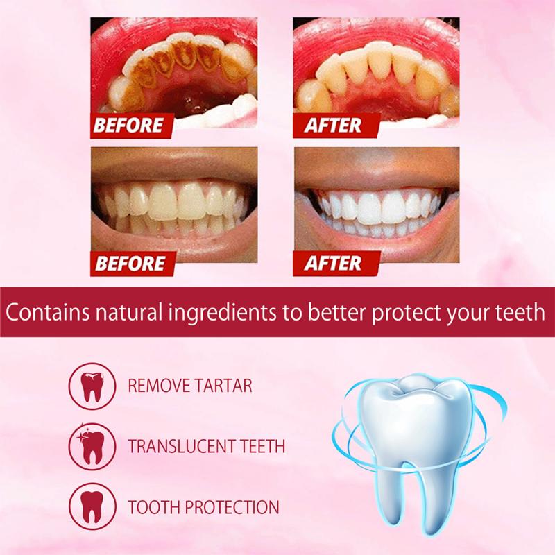 🔥Limited Time Half-Off🔥 | Probiotic Whitening and Stain-Removing Toothpaste