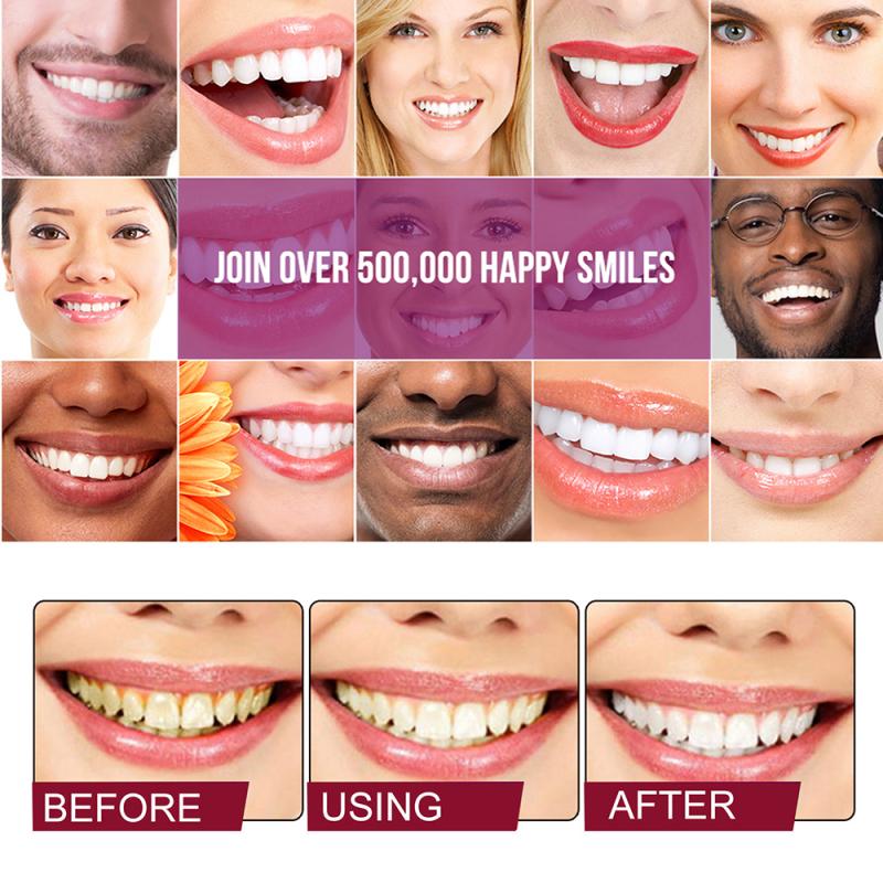 🔥Limited Time Half-Off🔥 | Probiotic Whitening and Stain-Removing Toothpaste
