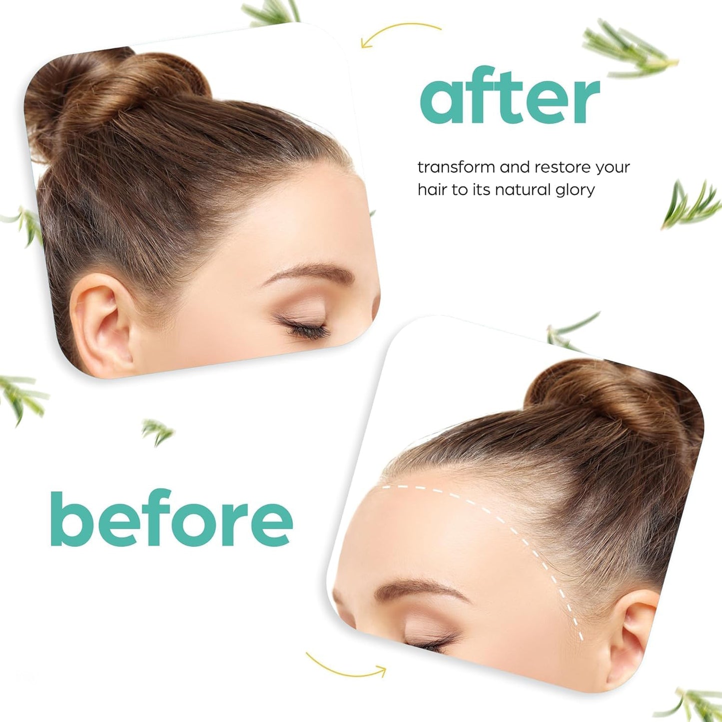 🔥50% off limited-time sale🔥 |Organic Rosemary & Castor Hair Growth Oil + Scalp Massager Set