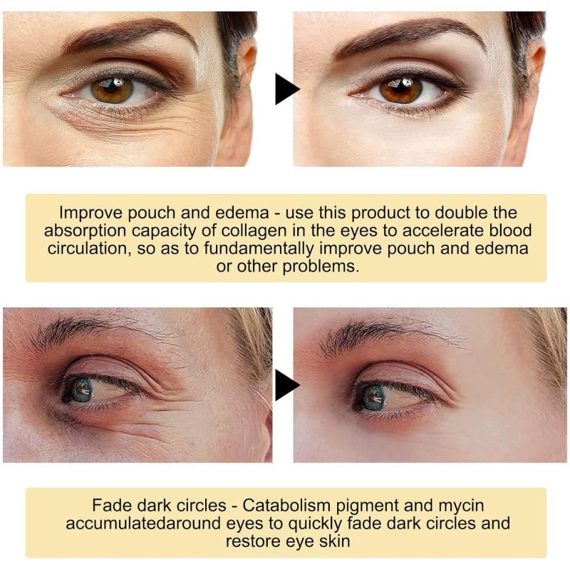 🔥Limited-Time 50% Off🔥 | Gold Hydrating Eye Mask