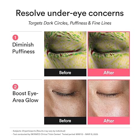 🔥50% off limited-time sale🔥 |PDRN Retinal Eye Patch Glow jelly 60 Patches