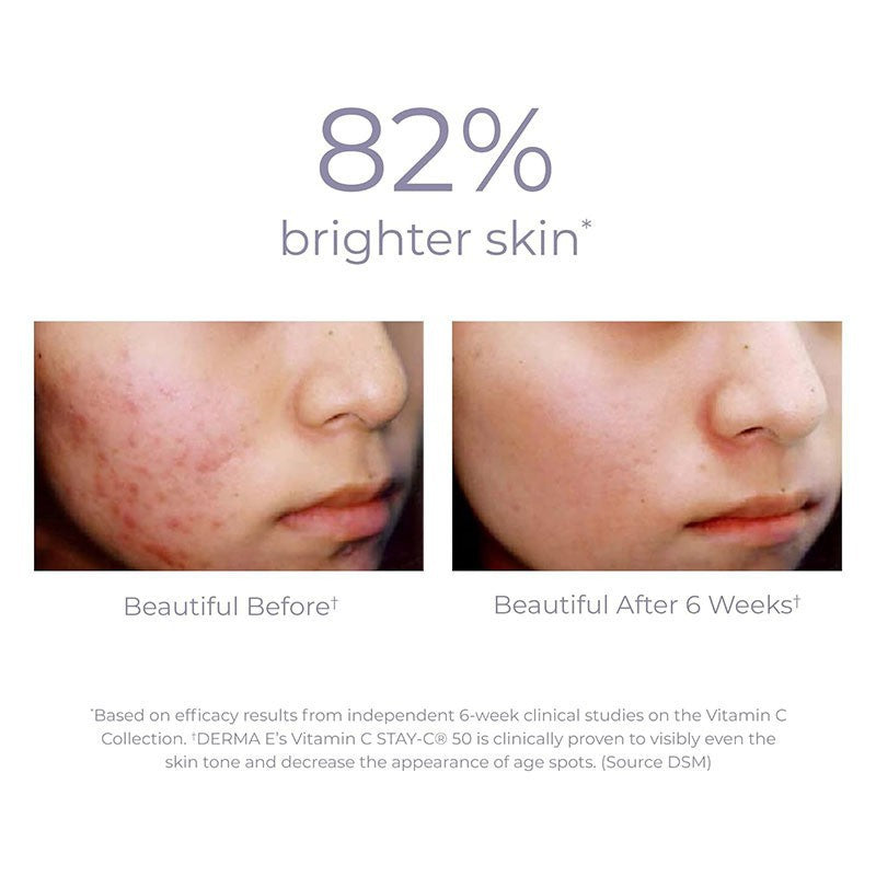 🔥50% off limited-time sale🔥 |Vitamin C Concentrated Serum with Hyaluronic Acid