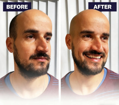 🔥50% off limited-time sale🔥 |Effortless Head Shaving: Must-Have Shaver For Bald Guys